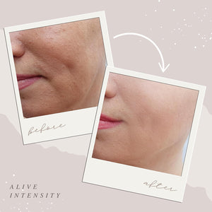 Caro cream & Hyaluronic Acid