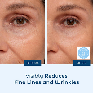 Caro cream & Hyaluronic Acid